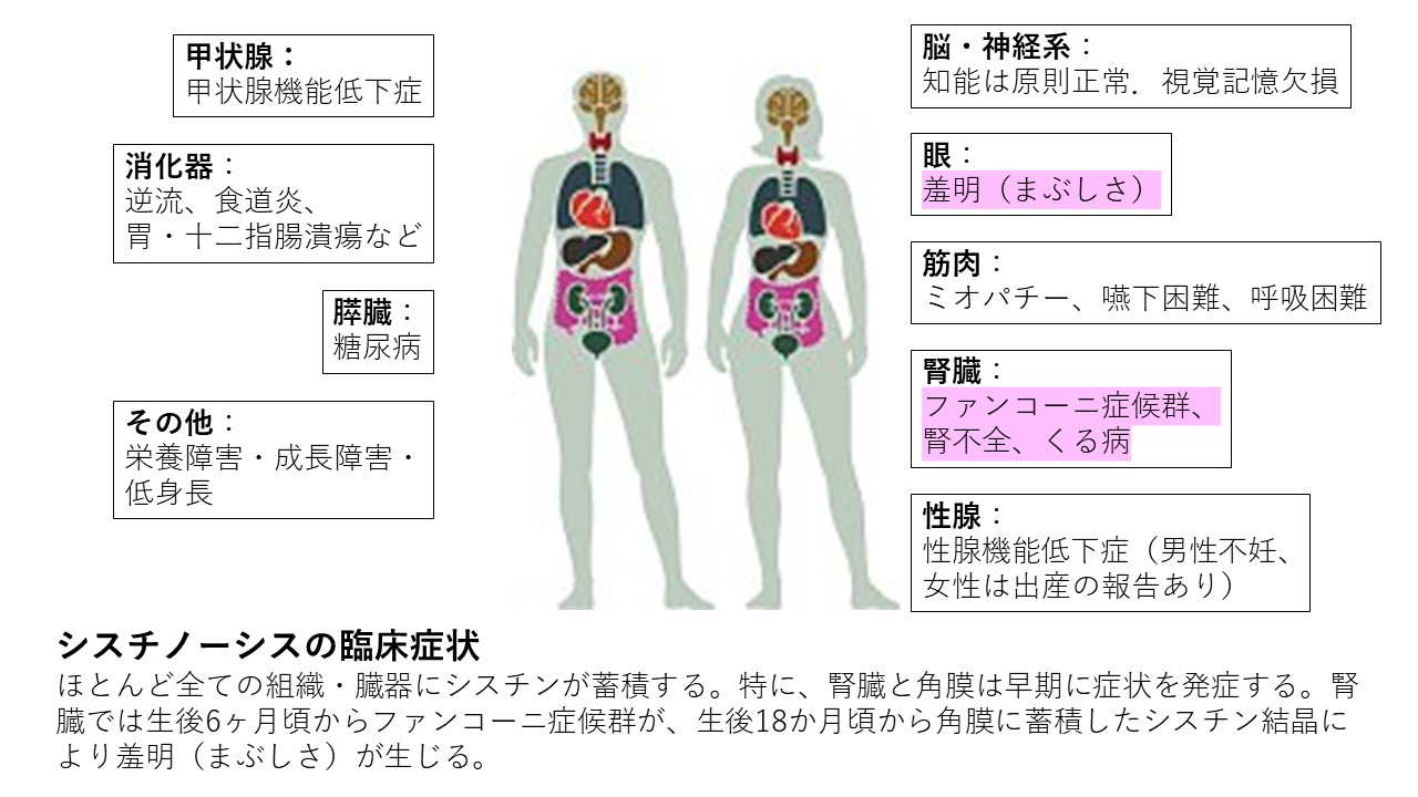シスチノーシスの臨床症状
