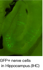 GFP+ nerve cells in Hippocampus.(IHC)