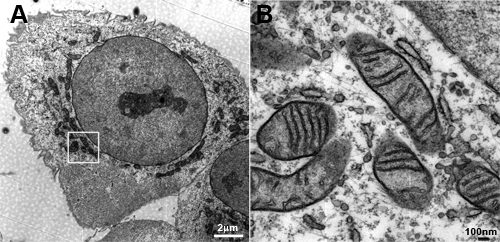 Transmission electron microscopy