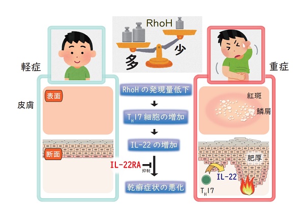 RhoH遺伝子を欠損したマウスではTH17細胞分化が亢進し、乾癬様慢性皮膚炎を発症する